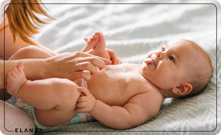 جلوگیری از عرق سوز شدن پای نوزاد