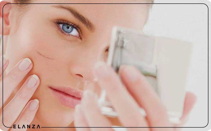 بهترین پماد ترمیم کننده زخم