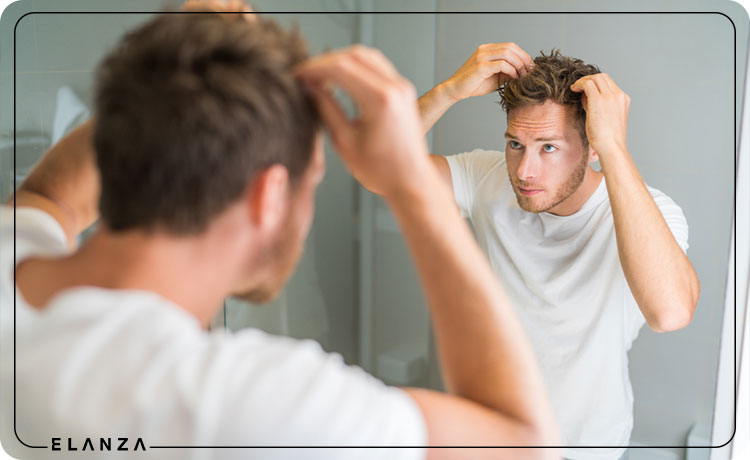درمان خانگی ریزش مو مردان