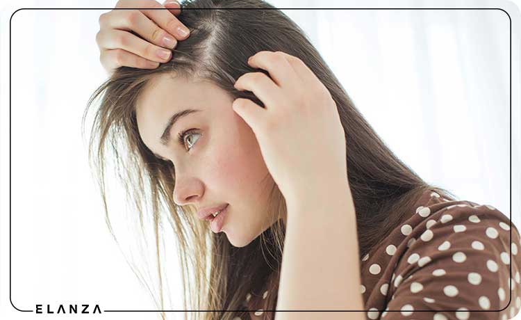 درمان ریزش مو شدید در زنان