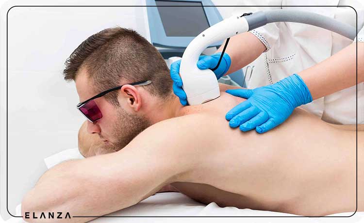 درمان قرمزی پوست با لیزر