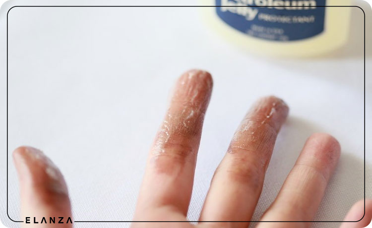 پاک کردن رنگ مو مشکی از روی دست