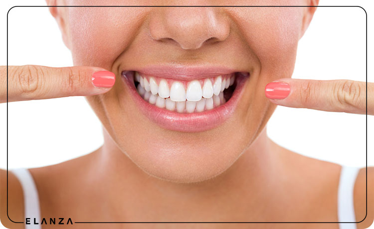 سریع ترین روش سفید شدن دندان در خانه
