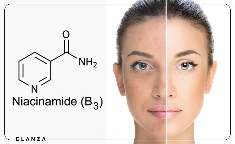 نیاسینامید چیست و چه کاربردی دارد