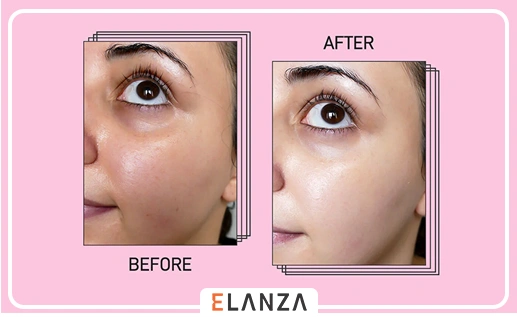 سریعترین ماسک روشن کننده