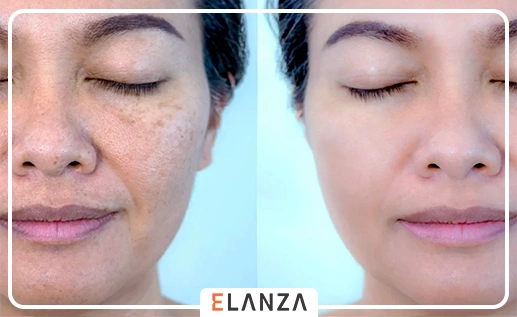 ماسک روشن کننده