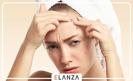 علت جوش پیشانی